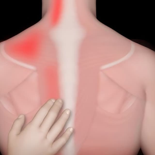MYOFASCIAL SAVE $324. (12) 90 min. at NEXT LEVEL HEALING, LLC. in Magnolia, TX